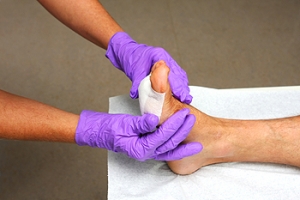 Foot Wounds Among the Elderly