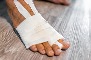 Treatment for Turf Toe Injuries