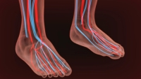 How Circulation Affects Nerve Pain in Diabetic Feet